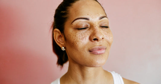 How Can I Rebuild My Skin Barrier?